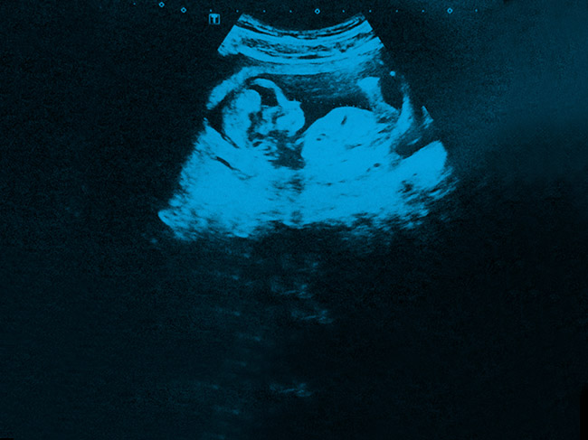 SantaCC - Con suerte, hay campañas que son un parto